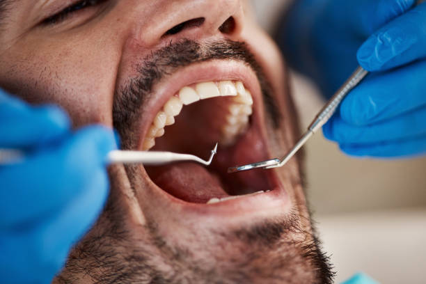 Best Emergency Denture Repair in Blauvelt, NY