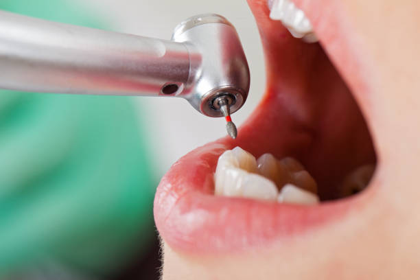 Best Broken or Chipped Tooth Repair in Blauvelt, NY